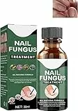 Soluzione per La Riparazione delle Unghie del Piede,Liquido Fungo per Unghie,Liquido per Infezione delle Unghie,Naturale Liquido Riparatore per Funghi delle Unghie per Unghie Danneggiate, Rotte