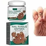 Crema di riparazione delle unghie,Crema per il trattamento delle unghie fungine,Cura delle unghie fungine,Trattamento del fungo del chiodo per la crescita delle unghie e la riparazione delle unghie