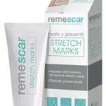 Remescar Trattamento Smagliature 100 ml - Crema per la Rimozione delle Cicatrici delle Smagliature - Tratta