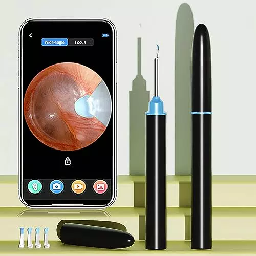 Otoscopio auricolare, videocamera auricolare, kit di videocamera per la rimozione del cerume 1080P HD con 6 luci LED