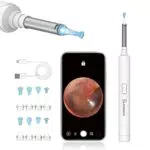 Otoscopio Detergente per Orecchie Portatile con Fotocamera HD e LED - Compatibile con Smartphone e Tablet